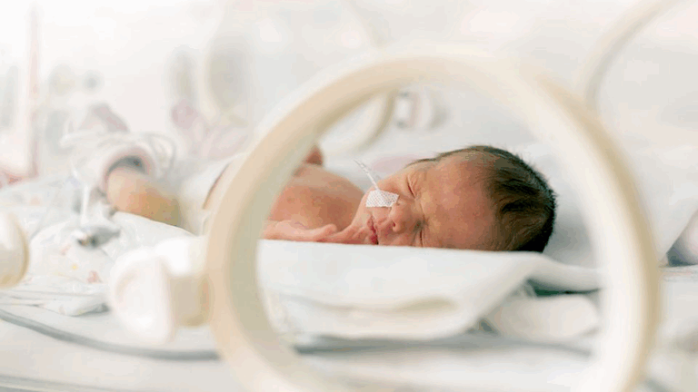 Tanda Kelahiran Prematur